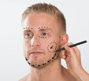 lipofilling-du-visage lipofilling du visage Tunisie