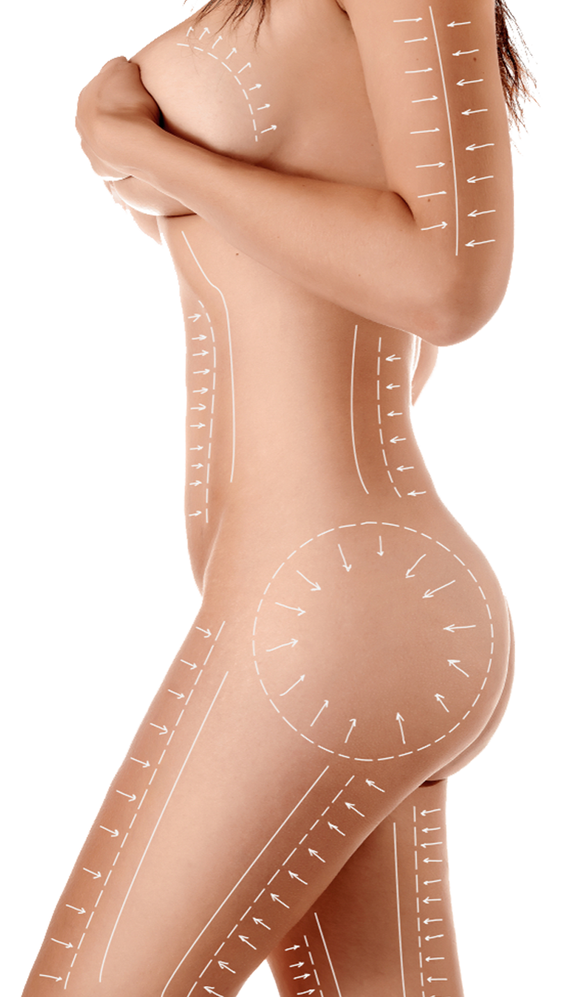 Liposuccion en Tunisie Liposuccion en Tunisie