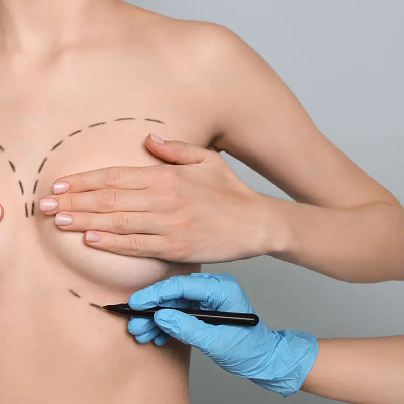 chirurgie mammaire Tunisie