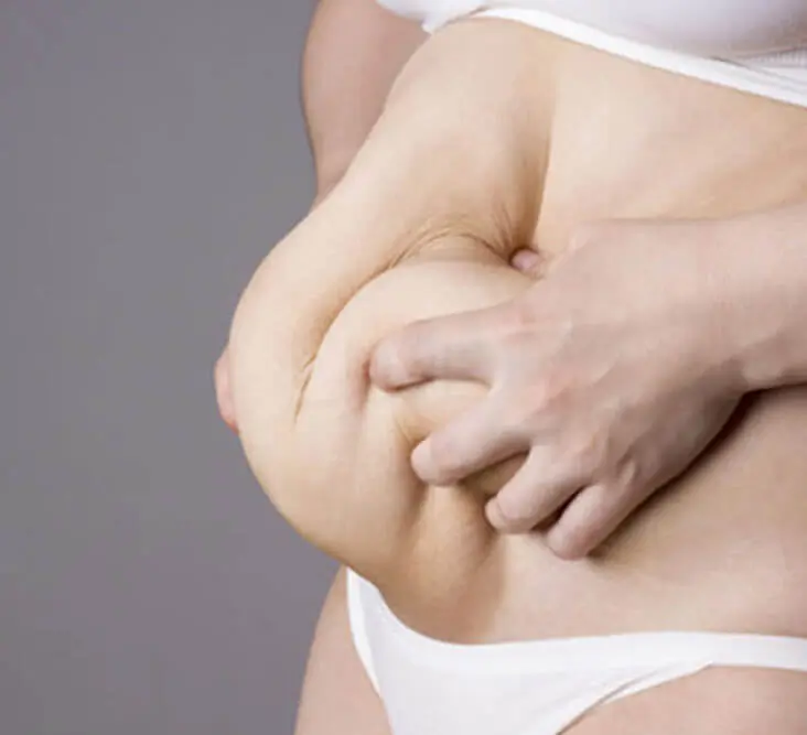 body lift Tunisie prix