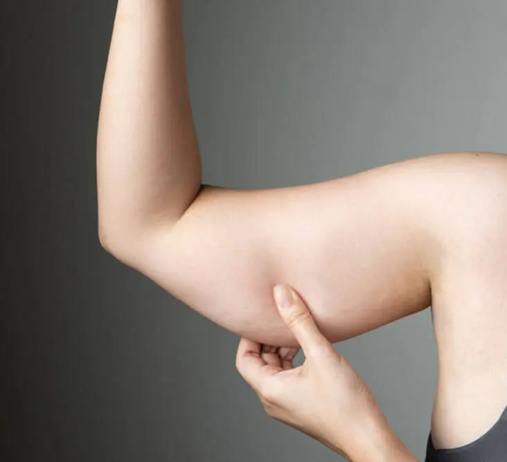 Lifting bras Tunisie - Clinique Liposuccion Tunisie